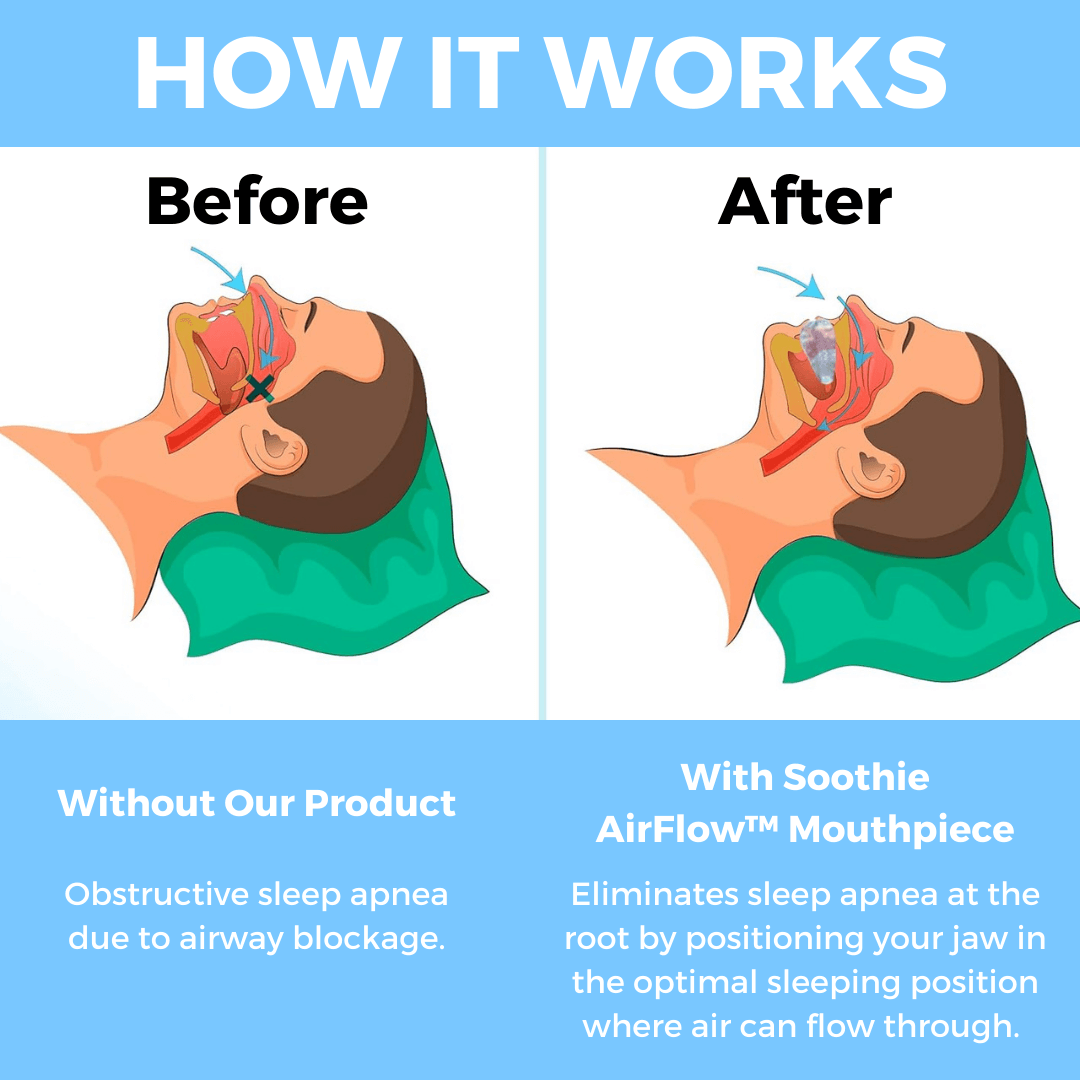 The AirFlow™ Mouthpiece